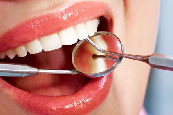 Détartrage Dentaire: Tout ce que Vous Devez Savoir sur le Détartrage Dentaire Maison