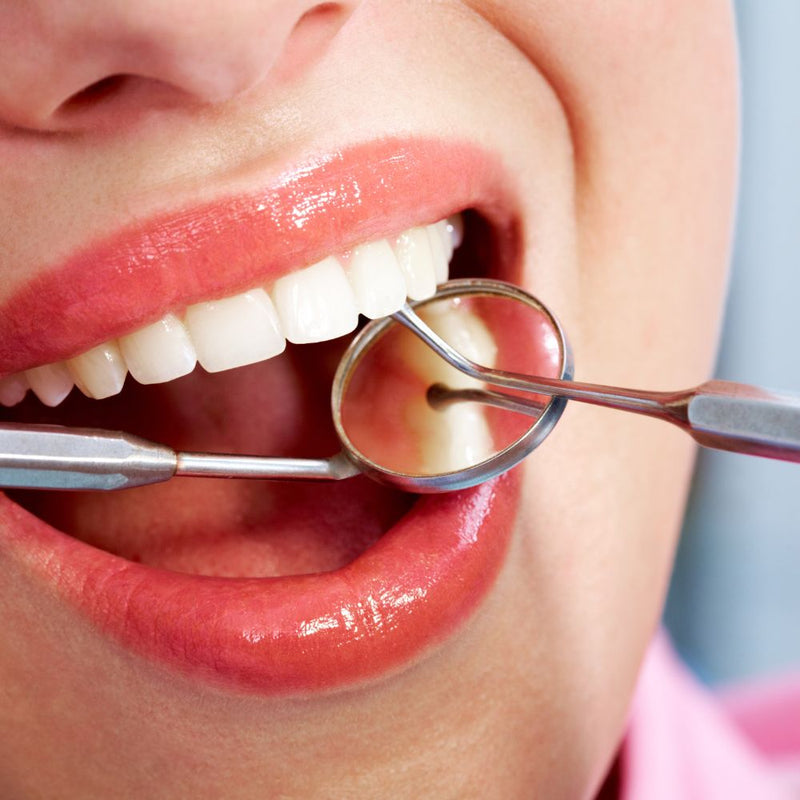 Détartrage Dentaire: Tout ce que Vous Devez Savoir sur le Détartrage Dentaire Maison