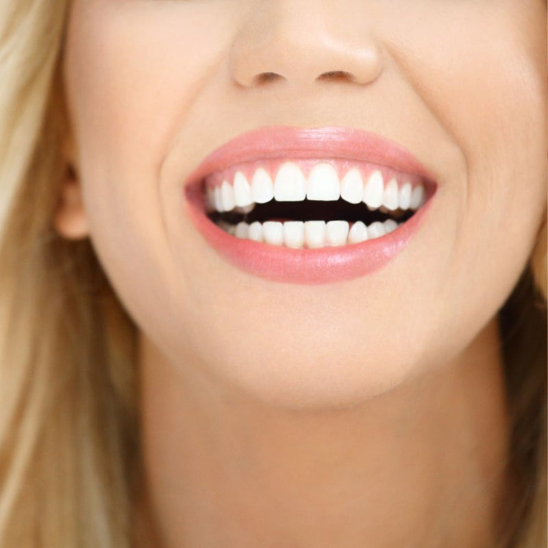 La Plaque Dentaire : Comment la Contrôler et la Prévenir?